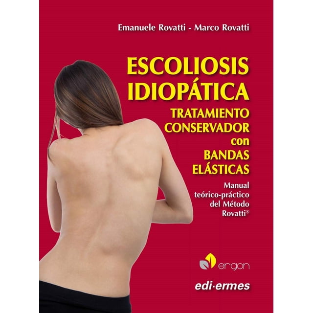 Escoliosis Idiopática. Tratamiento Conservador con Bandas Elásticas Ergon 9788870516418
