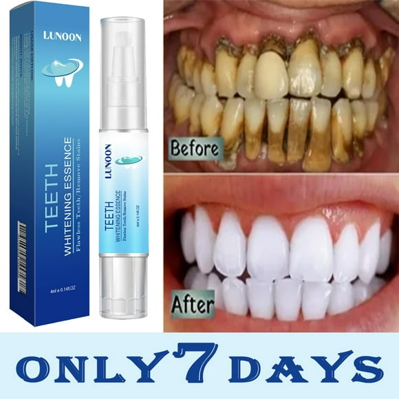 Teeth Whitening Pen Tooth Gel Whitener Bleach Remove Stains Instant Smile Teeth Whitening Kit Cleaning Serum Beauty Health