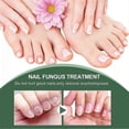 thumbnail image 5 of EELHOE 50ml Nail Fungus Treatment Solution Extracts Remove Onychomycosis No Yellowing Restore Shine Nail Repair Care, 5 of 5