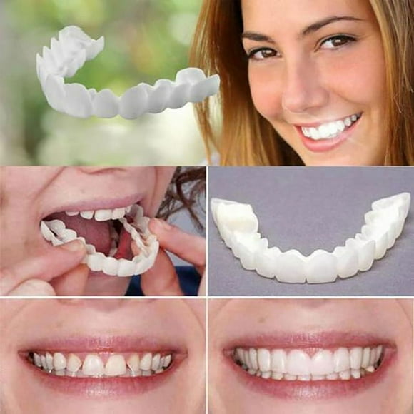 Snap Dental Veneers