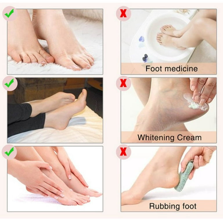 Foot Peel Mask to Exfoliate Dead Skin - Dermatologically Tested Exfoliating  Foot Mask to Get Baby Soft Feet - Callus Removal, Dead Skin Cracked Heel