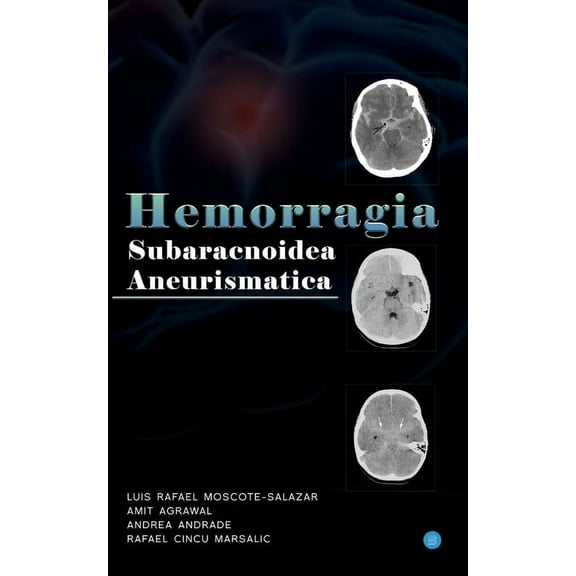 Hemorragia Subaracnoidea Aneurismatica, (Paperback)