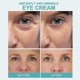 thumbnail image 4 of Crema para Ojos Yuxing Antiarrugas Instantánea que Atenúa las Ojeras y Antienvejecimiento 5 Piezas, 4 of 5