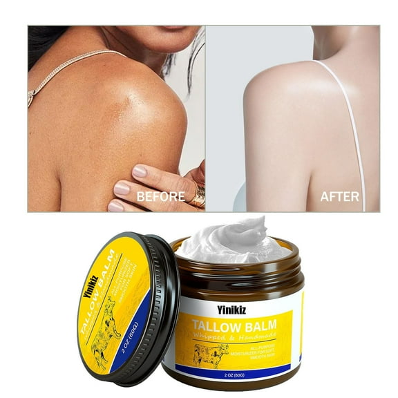 SDJMa Handmade Whipped Tallow Balm for Skin Care,All Natural Grass Fed Beef Tallow All Purpose Balm,Face and Body Moisturizing Cream, Hydration for Dry,Sensitive Skin Care 60g