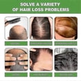 thumbnail image 5 of Champú de romero con biotina, 2 unidades, tratamiento para estimular el crecimiento saludable del cabello, 5 of 5