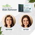 thumbnail image 2 of Herbishh Hair Color Stain Remover Wipes - Gentle Formula for Dye Cleanup, Skin-Friendly Travel Pack (Pack of 5), 2 of 7