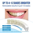 thumbnail image 2 of Bolígrafo blanqueador dental VieBeauti con 35% de peróxido de carbamida, paquete de 7, 2 of 9