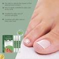 thumbnail image 3 of Nailfungus Treatments Pen For Damage Nails, Nourishing Strengthening Nails Liquid for Healthier Growth, for Men Women, 3 of 5