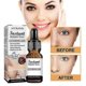 thumbnail image 3 of Esencia antiarrugas, suero facial Jaysuing, hidratante, reparador, blanqueador de la piel, antienvejecimiento, antiarrugas, cuidado profundo de la piel, acné., 3 of 4