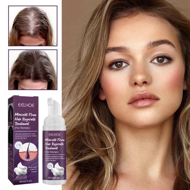Minoxidil Foam Hair Regrowth Treatment for Women Hungary Ubuy