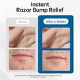 thumbnail image 2 of Razor Bumps Ingrown Hair Treatment Serum Post Shave and Waxing for Body Beard and Bikini Area Men and Women 3.38 fl oz, 2 of 7