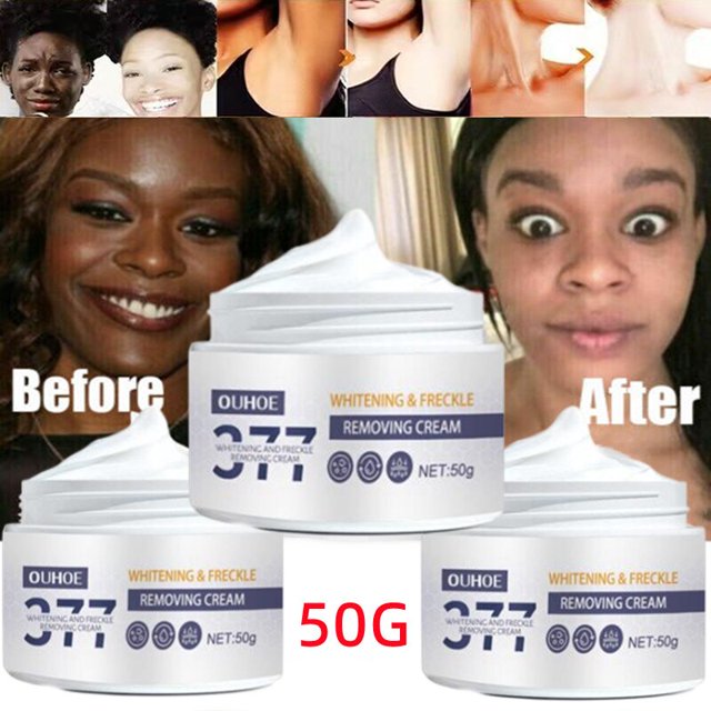 Crema facial antienvejecimiento de 30g, eliminación de arrugas, Lifting, reafirmante, líneas finas, blanqueamiento suave, productos hidratantes para el cuidado de la piel facial"01" Fivean LED