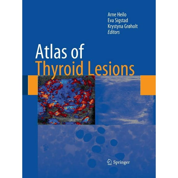 Atlas of Thyroid Lesions, (Paperback)