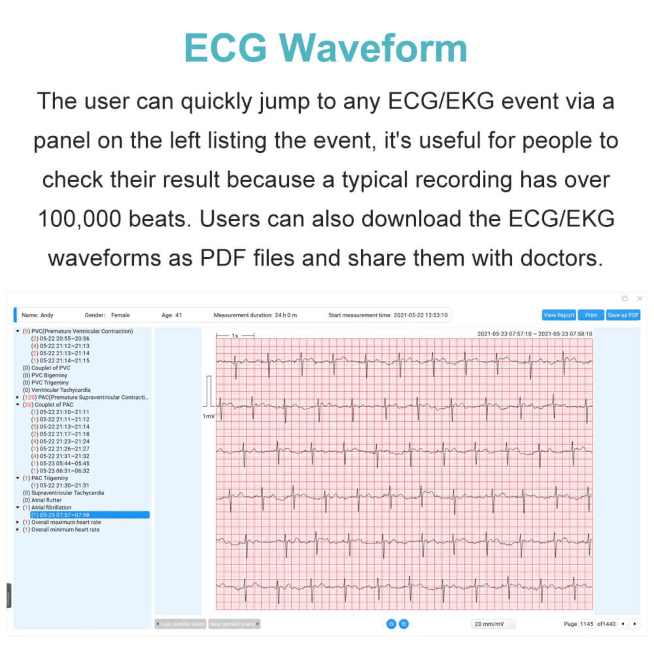Livenpace Heart Health EKG ECG Monitor,24 Hours AI ECG Monitor with Free AI Analysis and PC Report,Home EKG Heart Health Recorder, HHM1