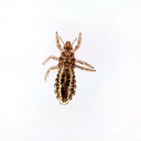 Pediculus Humanus Capitis  W.M. Microscope Slide price history on PriceWatchPro