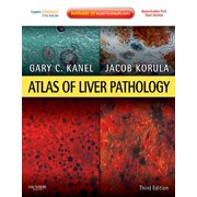 Atlas of Surgical Pathology: Atlas of Liver Pathology : Expert Consult - Online and Print (Edition 3) (Hardcover)