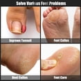 thumbnail image 3 of Kit de herramientas de pedicura SMZHealing de acero inoxidable de 7 piezas, 3 of 8