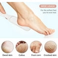 thumbnail image 4 of TRIANU 2 Pack Foot Files, Foot Callus Remover Professional Sandpaper Pedicure Tools Double Sided Foot Rasp File Depilation with Handle, Foot File for Dead Skin for Men and Women, White, 4 of 8