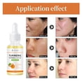 thumbnail image 4 of Fiudx Liquidación de ahorros de verano Suero corrector, manchas oscuras y cúrcuma, suero reparador e hidratante, 30 ml, 4 of 7