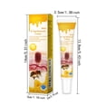 thumbnail image 2 of Promotional activities!Wart Cream Gram Wart Cream Skin Care Flat Wart Ointment Wart Removal, 2 of 8