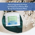 thumbnail image 2 of KP Elements Exfoliating & Soothing Skin Cream Keratosis Pilaris, 4 fl oz., 2 of 6
