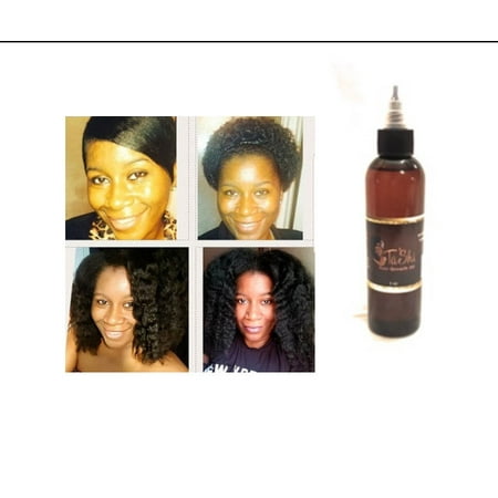 Ta' Shi Hair Growth Oil (Best Hair Growth Products Uk)