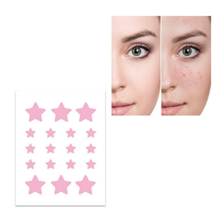 Star Face Pimple Patches, Acne Patch Pimple Patch, Star Shaped Acne Ab –  BABACLICK