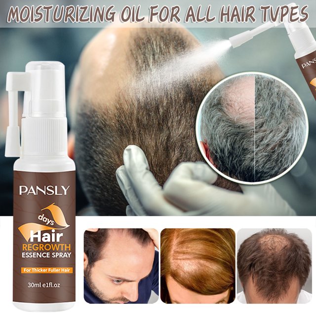 Spray Para Crecimiento del Cabello Acondicionador Sin Enjuague 30 ml Fiudx Ofertas y liquidaciones