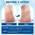 thumbnail image 4 of OUKEYA 40 Percent Urea Foot Cream Tube with Blue Nano Foot File, 4 of 9