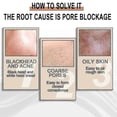 thumbnail image 4 of Jaysuing lactobionic acid liquid deeply cleanses, gently removes blackheads, exfoliates, shrinks pores and moisturizes the skin | |, 4 of 5
