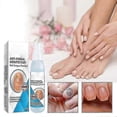 thumbnail image 2 of 3PCS Nail Repair Spray Repair And Clean Nails, Hands, Feet, Soft Nails, Thicken Nails, Polish Nails100ml (PrettyJ), 2 of 5