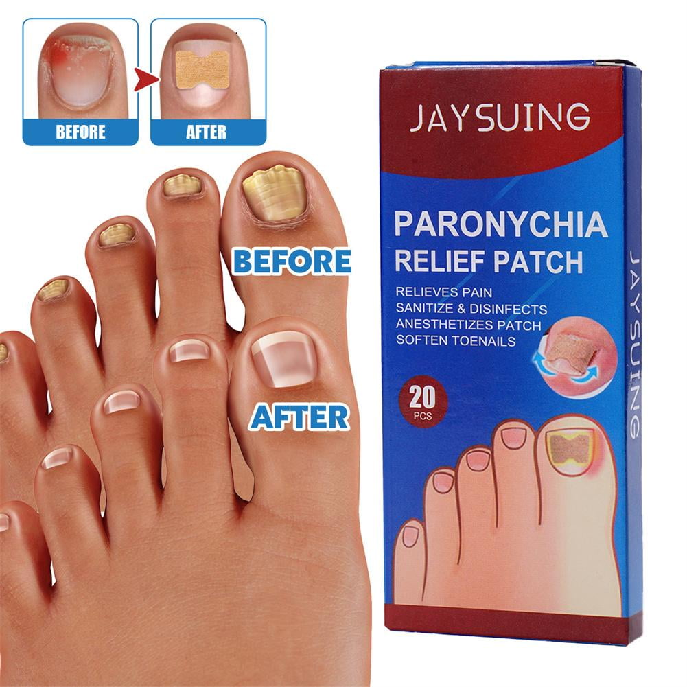20 Patches Anti Fungal Nail TreatmentToeFungus Onychomycosis Repair