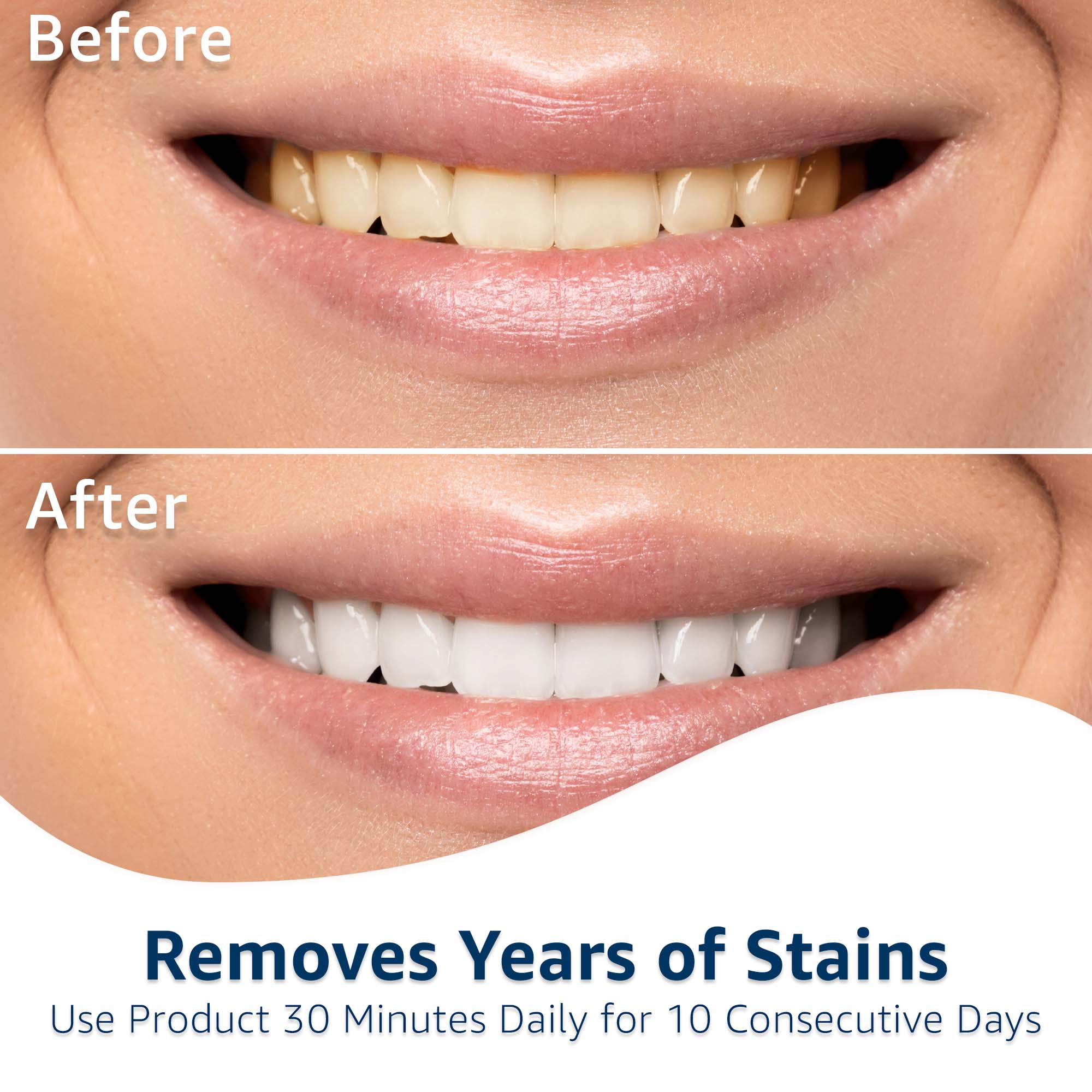 Equate 10-Day Timeless White Teeth Whitening Strips photo 4