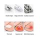 thumbnail image 5 of Tijeras de pedicura, cortaú?as de doble resorte encarnadas para u?as de los pies muertas, cortaú?as, herramienta de pedicura, cortaú?as de acero inoxidable Amonsee No, 5 of 5