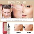 thumbnail image 4 of Syrup Essence No Black Mole, 20 ml, elimina y repara la piel decolorada, 4 of 5