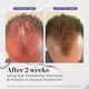 thumbnail image 5 of Champú Dr. Groot para engrosar el cabello para la caída del cabello con biotina, 5 of 9