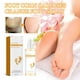 thumbnail image 4 of Cremas y lociones para pies Callos en los pies Spray para pies de naranja 30 ml crema para pies, 4 of 5