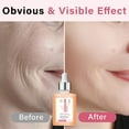 thumbnail image 2 of Squalane Oil for Face, Hydrate, Nourish, and Revitalize Your Skin,Deep Hydration and Moisture Lock,Anti-Aging and Skin Firming,30ml, 2 of 8