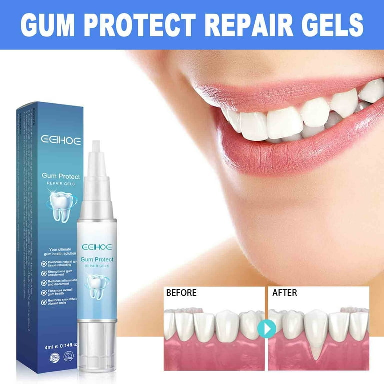 SDJMa Gum Gel - Gum Shield Gel - Teeth Whitening Essence Pen