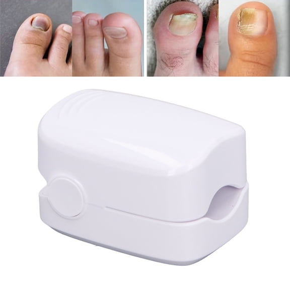 Dispositivo De Tratamiento De Uñas, Luz Portátil Eficiente Para Limpieza De Uñas De Los Pies Para La Vida Diaria