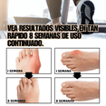 thumbnail image 3 of 1 Par Calcetines Terapia Correctores Juanete Dedos Negros, 3 of 9