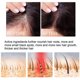 thumbnail image 3 of West & Month dense hair essence spray hair root growth anti-fall solid hair strengthening massage scalp essence, 3 of 5