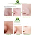 thumbnail image 6 of AICHUN BEAUTY Face Acne Cleaning Cream Skin Care Remove Repair Comedone Pimple Acne Face Acne Cream, 6 of 9