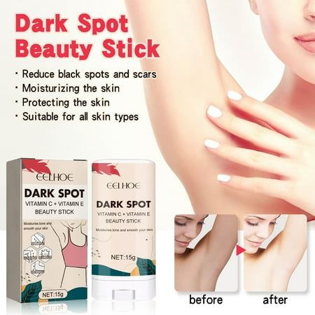 

mtvxesu Black Spots Removal Stick Dark Spots Corrector Cream Fade Out The Skin Black Precipitate Clearance Sale