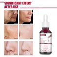 thumbnail image 4 of Suero exfoliante facial Suero de ácido salicílico AHA BHA Extracto de ácido de frutas Reducción de poros Ehuebsd  Cuidado Belleza, 4 of 6