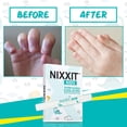 thumbnail image 3 of NIXXIT Nail Biting & Thumb Sucking Treatment for Kids with Denatonium Benzoate, 0.33 fl oz Bottle, 3 of 8