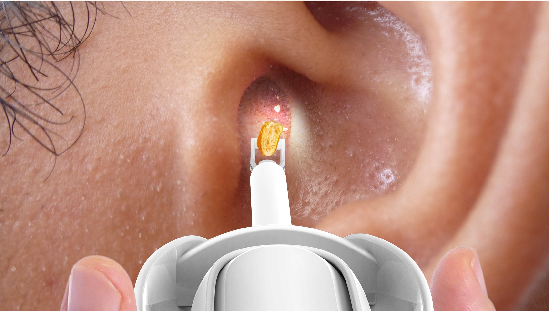 Bebird Home 30S Ear Care Pro