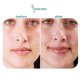 thumbnail image 5 of Lip Serum Plump and Moisturizing Lip Oil, Bp Spicule Plumping Lip Shot - Maxi, 5 of 5