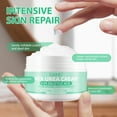 thumbnail image 4 of Elaimei 40% Urea Cream,Foot Moisturizer for Feet, Heels, Hands, Ankles, Deep Moisturizing,Foot Repair Lotion,3.52 oz, 4 of 10