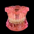 thumbnail image 1 of Dents d'Étude Dentaire Modèle Transparent Maladie Pathologique chez l'Adulte Dentisterie Dentaire, 1 of 5